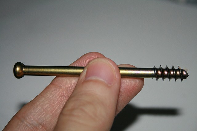 Pisu txiki bat kendu dut gainetik