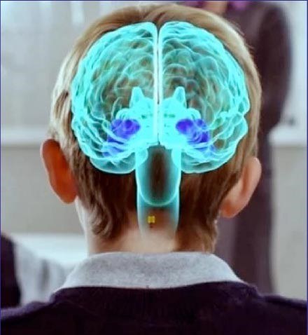 Neurohezkuntza: nola ikasten du garunak?